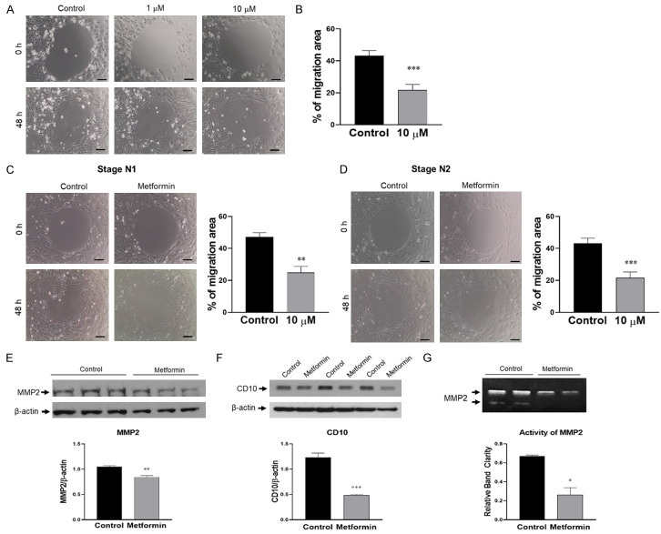 二甲雙胍在胰腺導(dǎo)管腺癌3D共培養(yǎng)模型中的抗癌作用