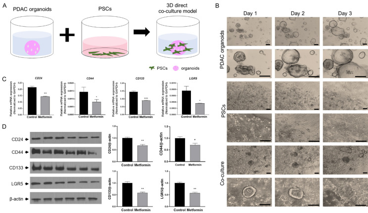 二甲雙胍在胰腺導(dǎo)管腺癌3D共培養(yǎng)模型中的抗癌作用