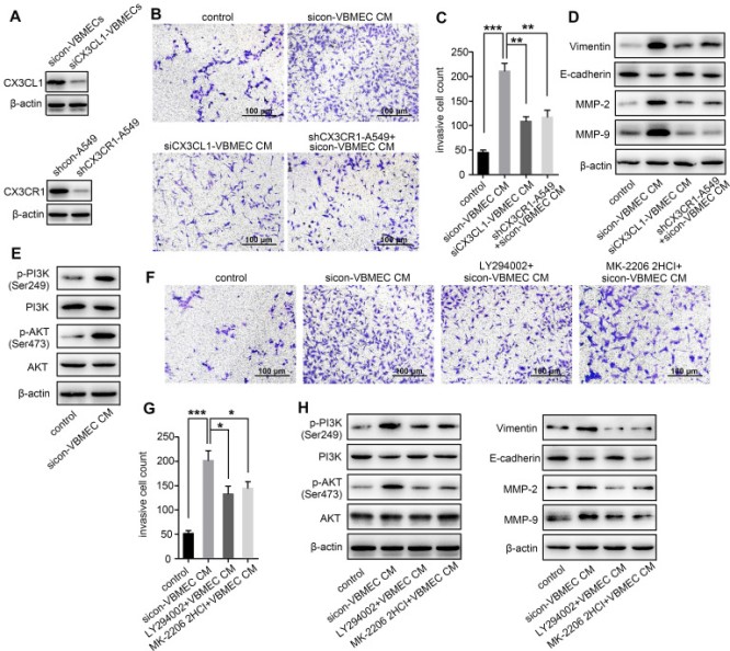 預(yù)防NSCLC脊柱轉(zhuǎn)移的潛在新靶點(diǎn) 預(yù)防NSCLC脊柱轉(zhuǎn)移的潛在新靶點(diǎn)