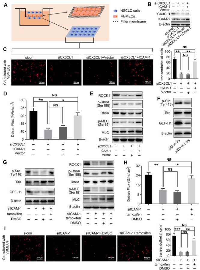 預(yù)防NSCLC脊柱轉(zhuǎn)移的潛在新靶點(diǎn) 預(yù)防NSCLC脊柱轉(zhuǎn)移的潛在新靶點(diǎn)