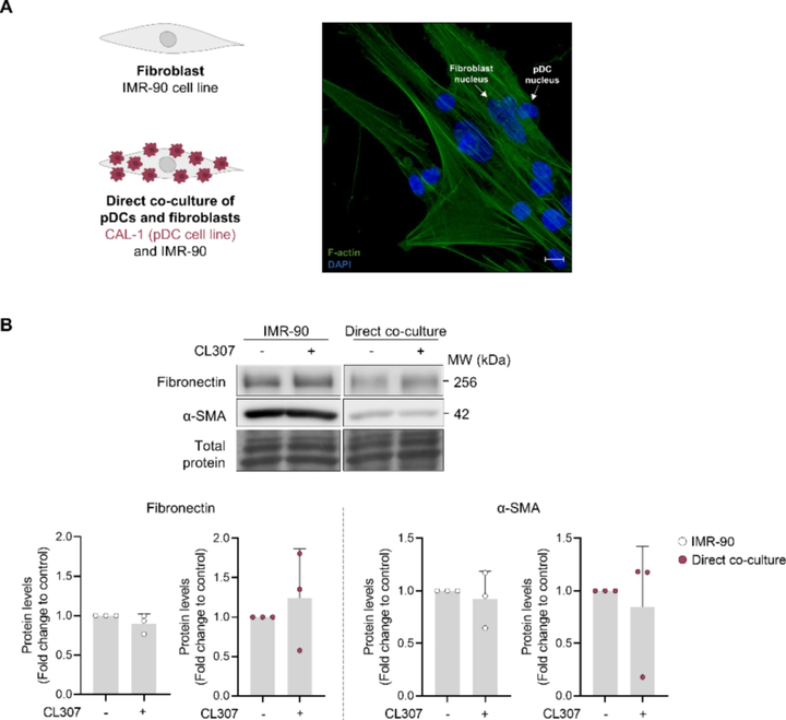 在漿細(xì)胞樣樹(shù)突狀細(xì)胞系中促進(jìn)內(nèi)質(zhì)網(wǎng)應(yīng)激可驅(qū)動(dòng)成纖維細(xì)胞活化