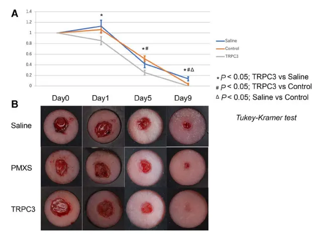 拉伸通過增強(qiáng)成纖維細(xì)胞中內(nèi)皮素受體B和TRPC3 的表達(dá)來促進(jìn)傷口收縮