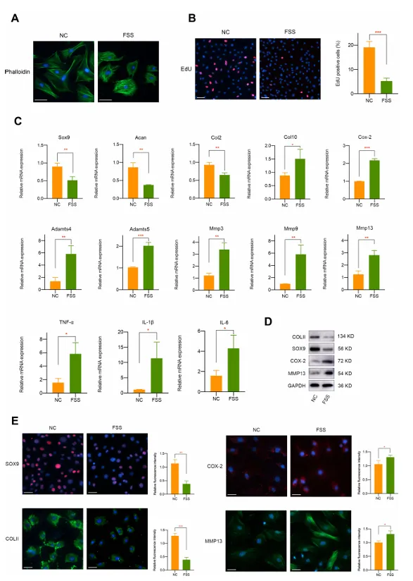 異常流體剪切應(yīng)力通過(guò) H3K4me3 對(duì) ZBTB20 的表觀(guān)遺傳調(diào)控促進(jìn)關(guān)節(jié)軟骨發(fā)病機(jī)制